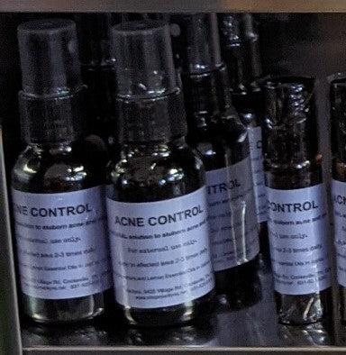 *Acne Control!  An All Natural Massage Oil for Acne and Skin Inflamation*